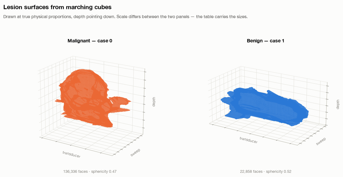 Lesion surfaces reconstructed by marching cubes for a malignant and a benign lesion, drawn at true physical proportions